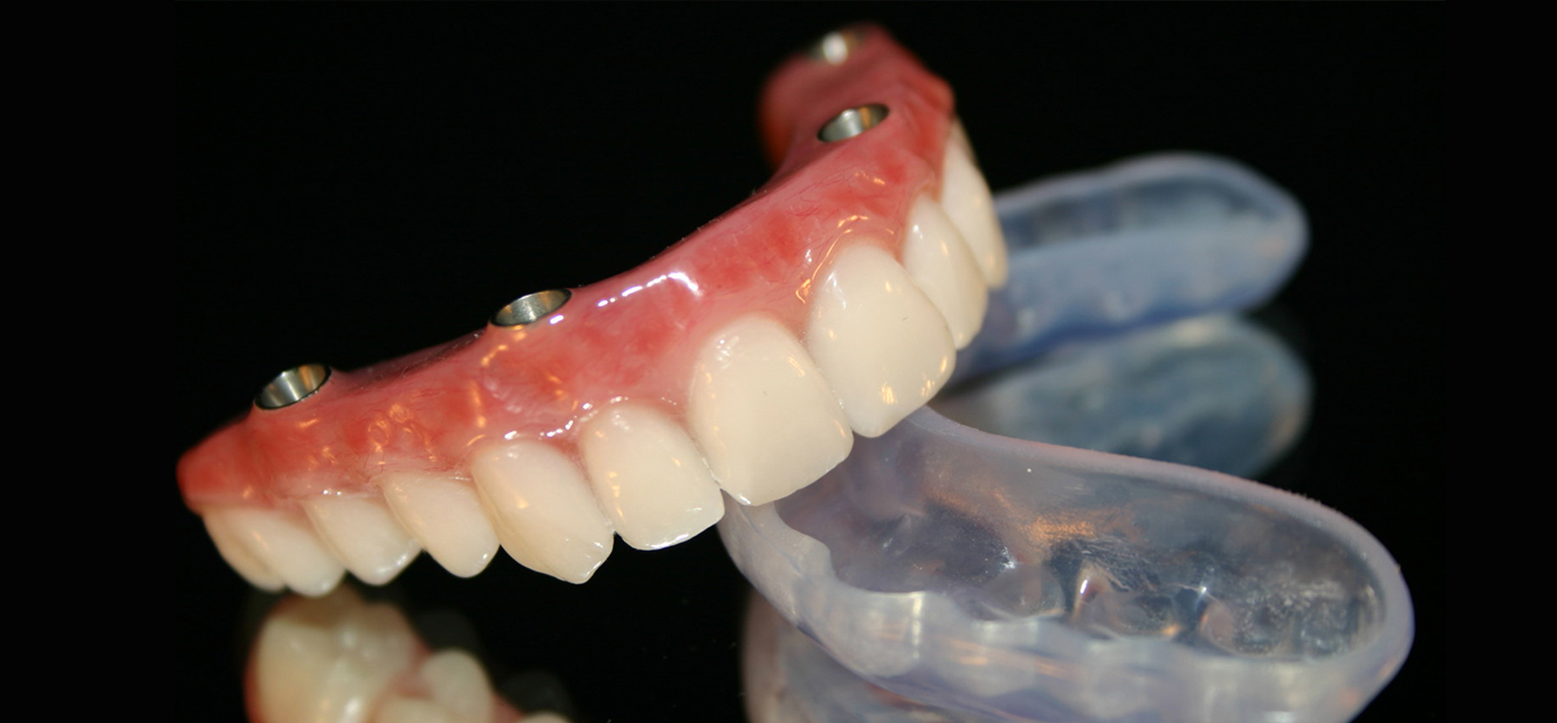 Centro Protésico Dental